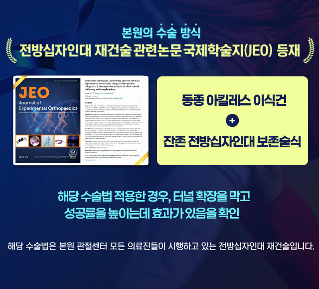 전방십자인대재건술